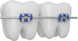 teeth braces 3d render icon png