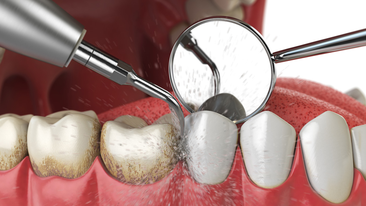 Periodontal Specialists Near Me