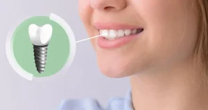 Dental implants in Flint long-lasting tooth replacement solution