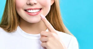 Smile Makeover Using Best Dental Veneers