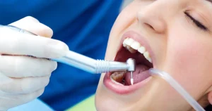 what to expect during root canal treatment