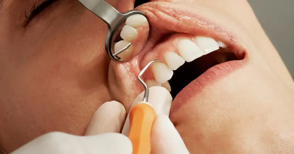 choose the right dentist for dental implants