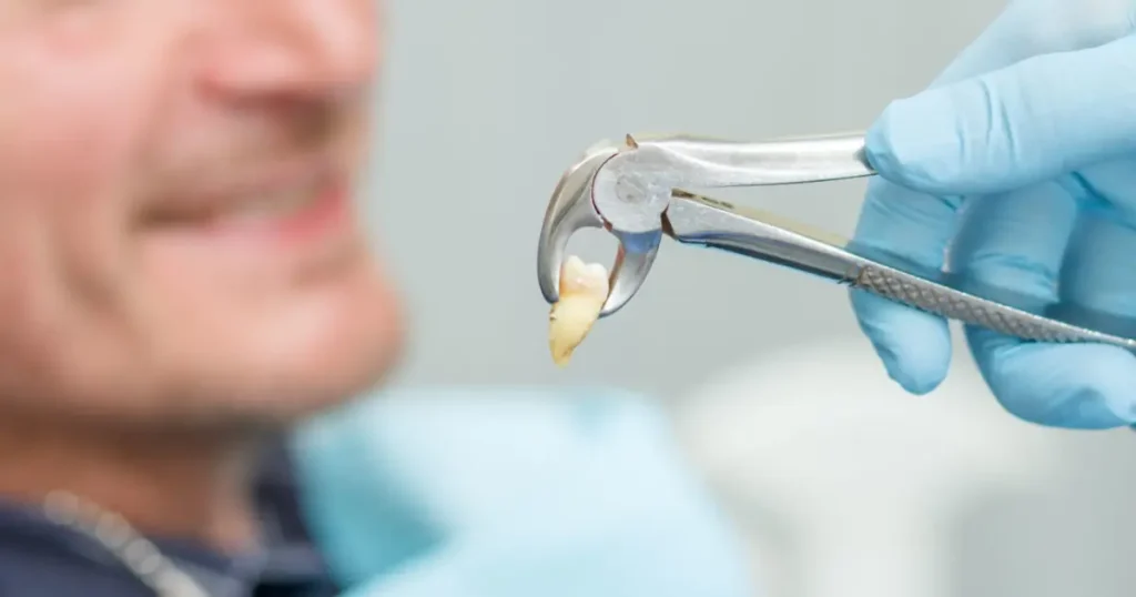 tooth extraction cost in Flint, MI