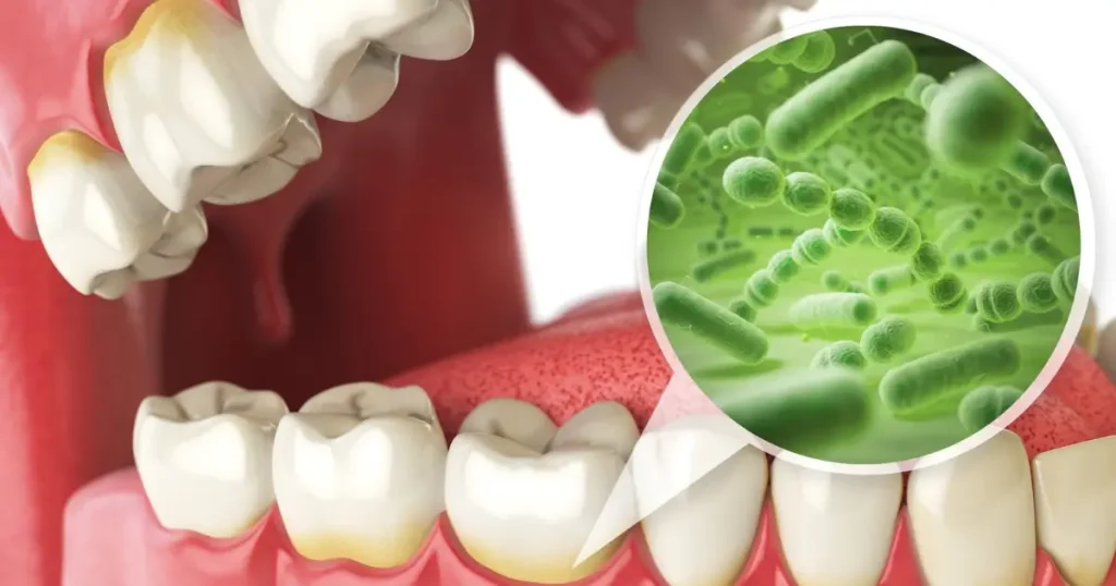 gum disease treatment in Flint, MI